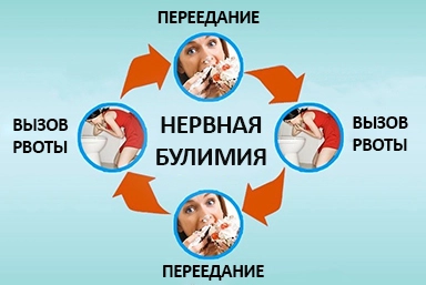 Лечение булимии в Первомайске